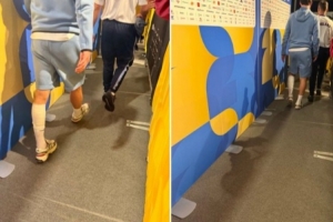 赖斯赛后一瘸一拐地穿过混合采访区，左小腿绑着绷带